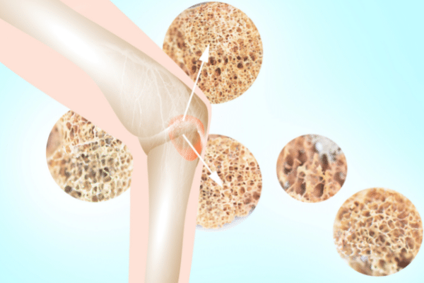 Comment puis-je renforcer mes os ?